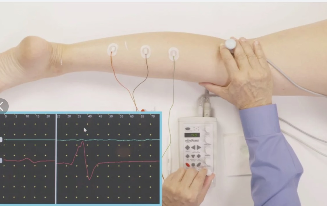                         The activity of H-reflex of calf muscles during fatigue in athletes
            